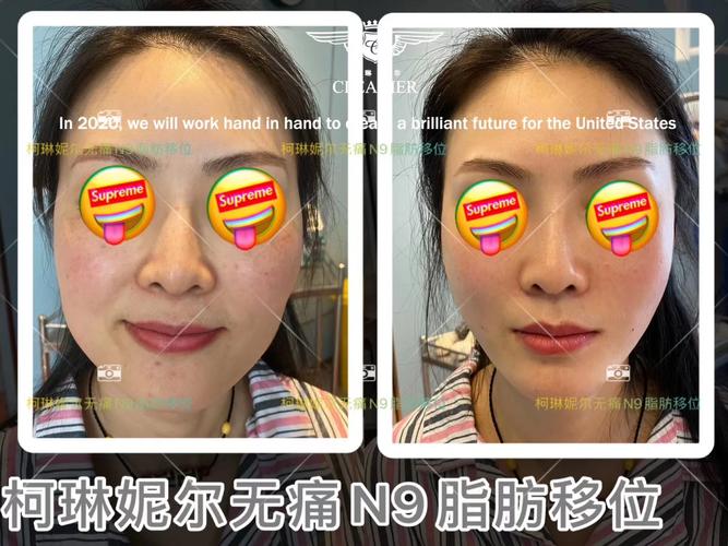 泉州哪的做人流手术医院好
