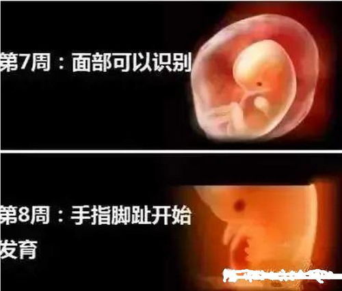 孕妇咽炎怎么办