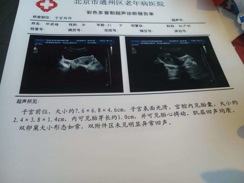 肥西做无痛人流手术好的医院是哪家