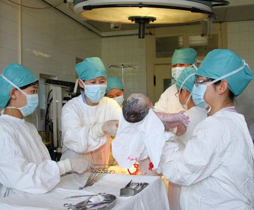北京首次取消绿化带挡盐板