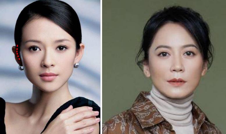 抚顺好的做人流手术医院是哪个 普通人工流产和无痛人流的区别 抚顺好的做人流手术医院是哪个 普通人工流产和无痛人流的区别