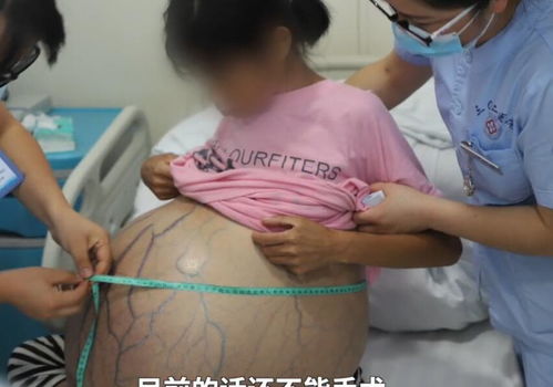 漳州做人流手术较好的医院