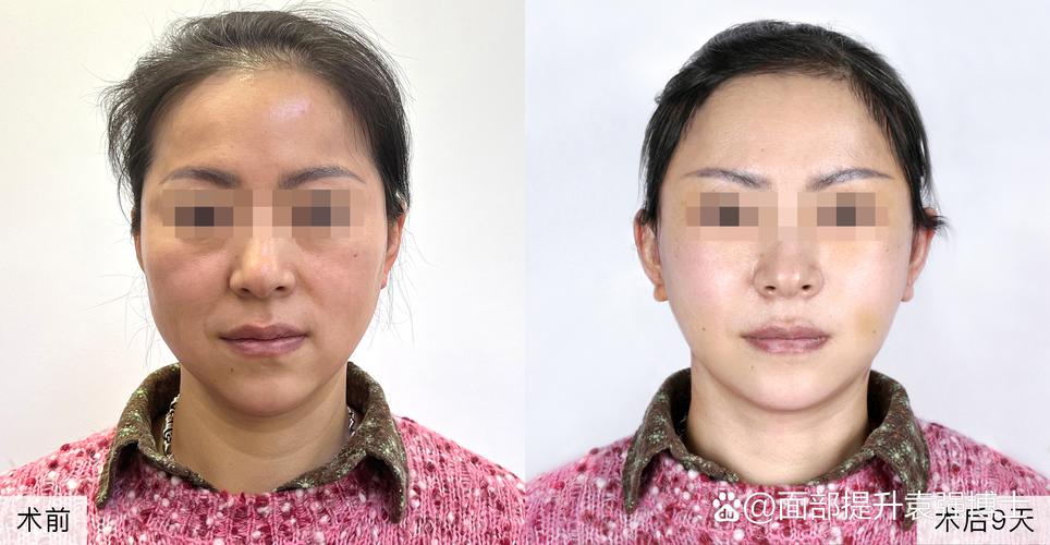 洛阳好的做人流手术医院有哪些 一次人流会导致不孕吗