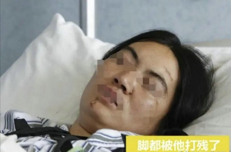 河源做无痛人流手术去哪个医院好