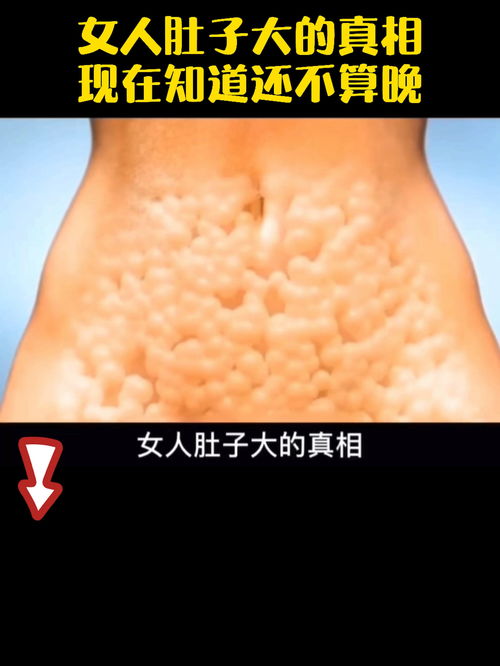 无痛人流第三天腰疼 蚌埠专门做人流手术医院哪里好