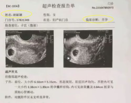 人流后你如何爱护自己
