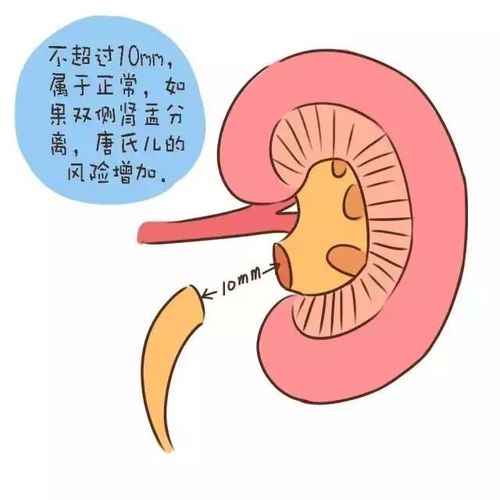 闷怎么组词 闷怎么组词多音字