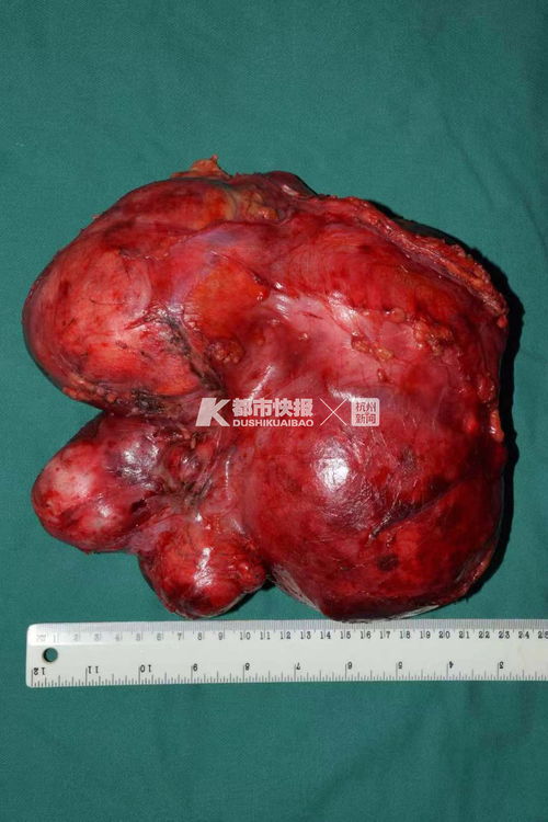 中医把脉能够看出做过人流吗 邢台做人流手术可信的医院 中医把脉能够看出做过人流吗 邢台做人流手术可信的医院