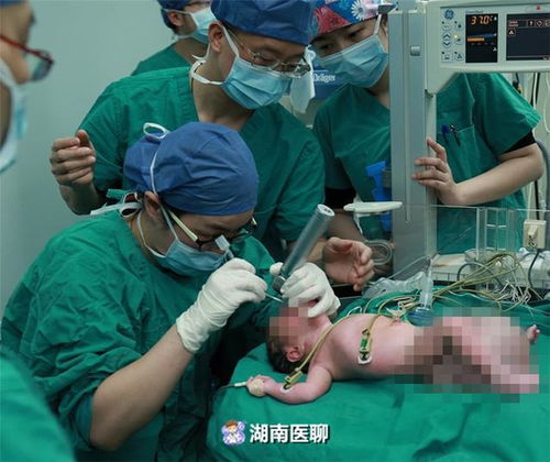 人流会不会影响运势(人流影响一个人的财运吗) 人流会不会影响运势(人流影响一个人的财运吗)