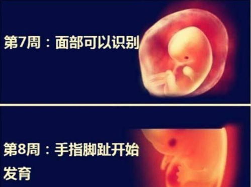 人流术后恢复注意事项 沈阳做人流手术好的医院