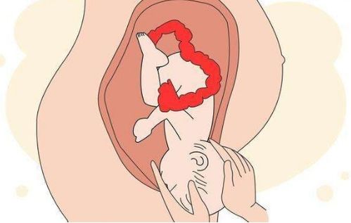 人流后乳腺疼怎么办 上海好的做人流手术医院是哪家 人流后乳腺疼怎么办 上海好的做人流手术医院是哪家