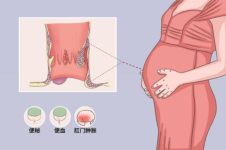 阿克苏做无痛人流手术什么医院好 人流前膀胱炎犯了会影响手术吗 阿克苏做无痛人流手术什么医院好 人流前膀胱炎犯了会影响手术吗