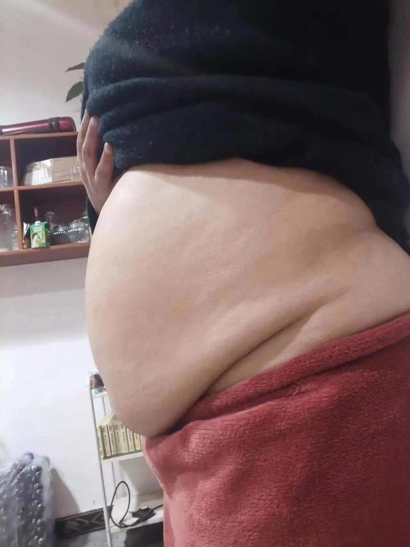 临沂做人流手术哪家医院 人流会导致不孕不育吗 临沂做人流手术哪家医院 人流会导致不孕不育吗