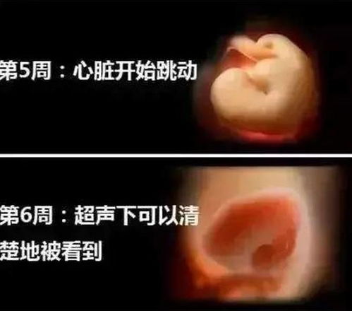 为什么美国欠20万亿美元债务，还不会破