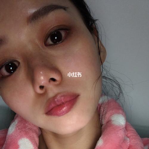 人流前要做哪些妇科检查