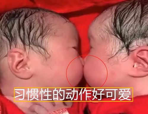 人流之后吃什么水果好呢
