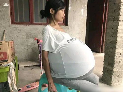 在人流后可以吃大闸蟹吗