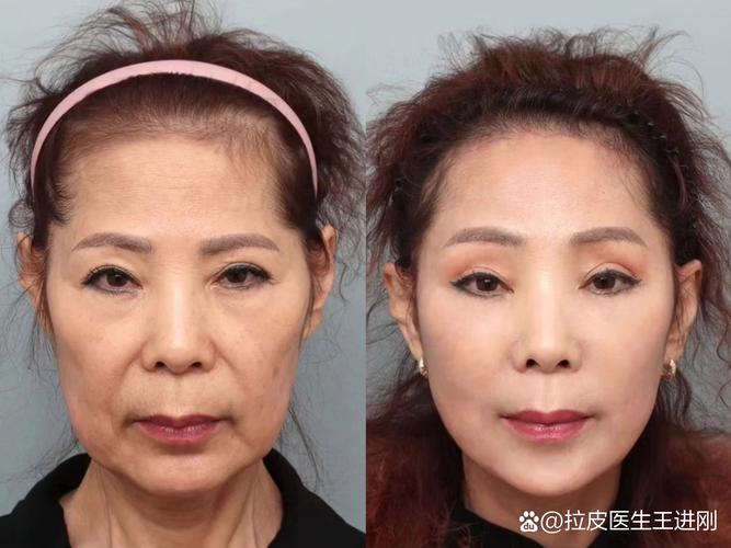 女性人流后为何易致不孕 