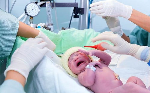 苏州做人流手术去哪家医院好 做完人流多久可以健身