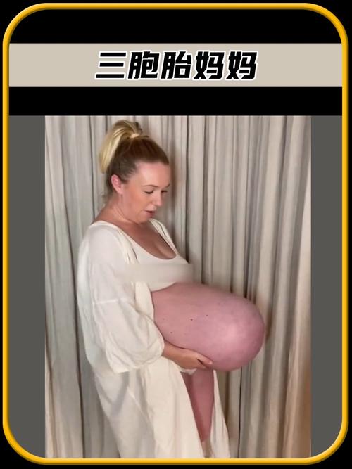 新塘医院妇科有药流 新塘医院妇科有药流手术吗