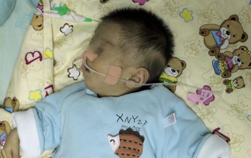 吃药人流的危害和注意事项有哪些 嘉兴的人流医院