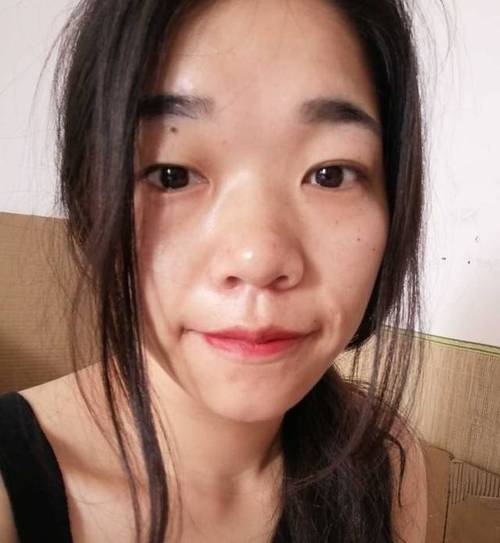 人流后多久血hcg转阴 漳州哪个医院可以做人流手术