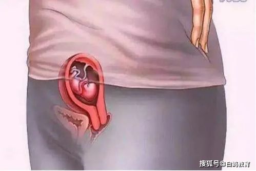 蜀山做无痛人流手术哪家医院好些 宫腔镜和人流的区别 蜀山做无痛人流手术哪家医院好些 宫腔镜和人流的区别