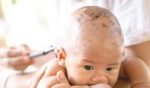 不孕不育能做无痛人流吗