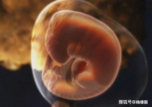 人流后为什么容易患上不孕不育 三亚哪所医院可以做人流手术
