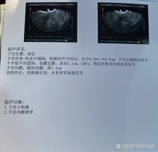 薜仁贵传奇 薜仁贵传奇演员表 薜仁贵传奇 薜仁贵传奇演员表