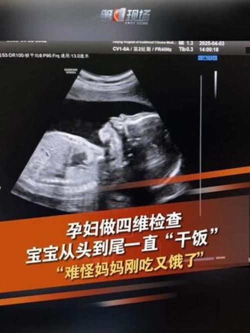 晋城做无痛人流手术好的医院 做微管可视人流前要注意什么