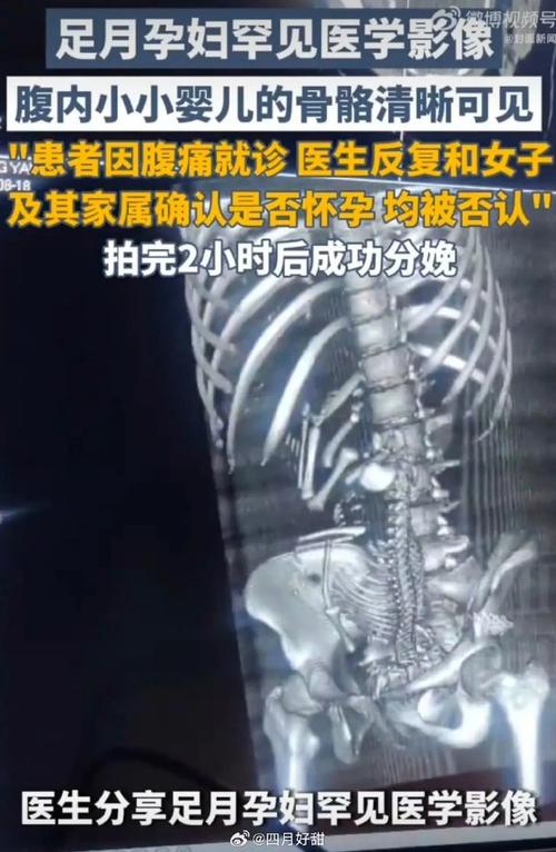 上海好的做人流手术的医院 做完人流后便秘怎么办 上海好的做人流手术的医院 做完人流后便秘怎么办