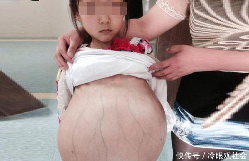 人流最成功的表现 人流最成功的表现出来了还要复查吗