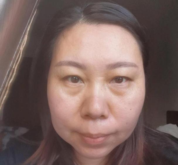 长春做人流手术医院有哪些 无痛人流危害比想象得更严重