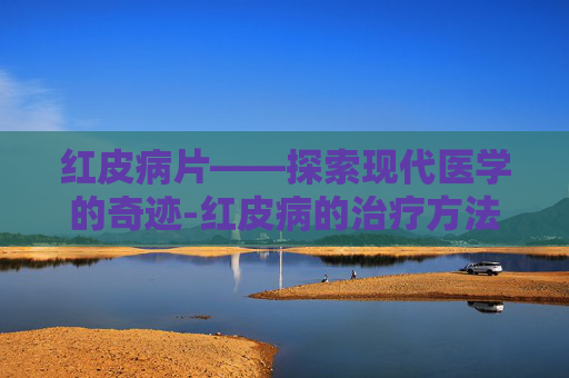 红皮病片——探索现代医学的奇迹-红皮病的治疗方法