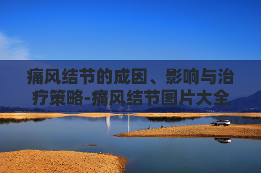 痛风结节的成因、影响与治疗策略-痛风结节图片大全 痛风结节的成因、影响与治疗策略-痛风结节图片大全
