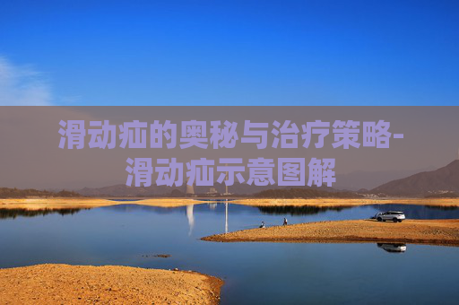 滑动疝的奥秘与治疗策略-滑动疝示意图解