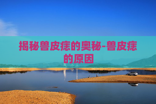 揭秘兽皮痣的奥秘-兽皮痣的原因