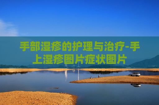 手部湿疹的护理与治疗-手上湿疹图片症状图片