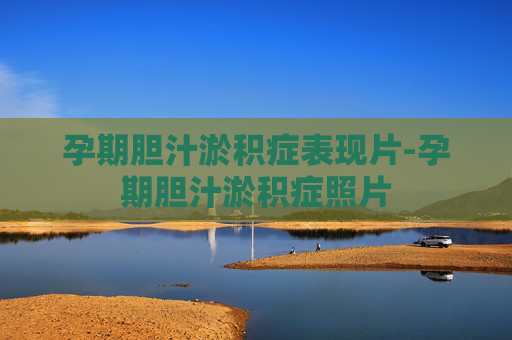 孕期胆汁淤积症表现片-孕期胆汁淤积症照片