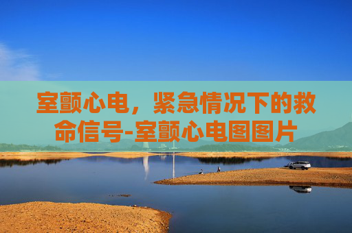 室颤心电，紧急情况下的救命信号-室颤心电图图片