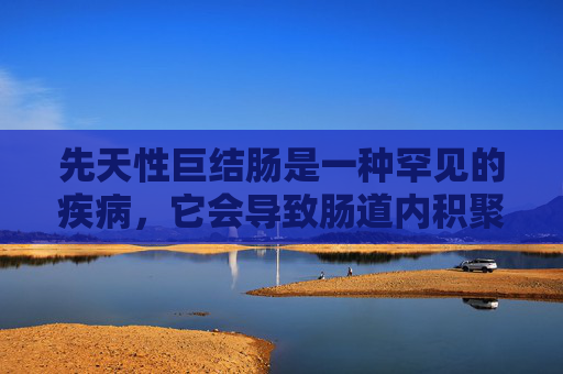 先天性巨结肠是一种罕见的疾病，它会导致肠道内积聚大量粪便，从而引起一系列症状。以下是关于先天性巨结肠的症状介绍，-宝宝先天性巨结肠有什么症状