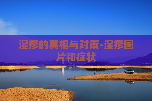 湿疹的真相与对策-湿疹图片和症状