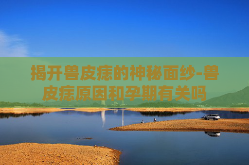 揭开兽皮痣的神秘面纱-兽皮痣原因和孕期有关吗