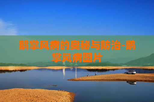 鹅掌风病的奥秘与防治-鹅掌风病图片