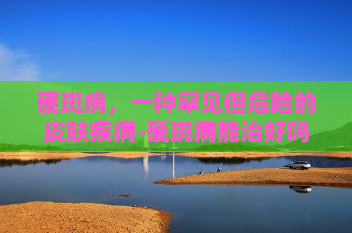 硬斑病，一种罕见但危险的皮肤疾病-硬斑病能治好吗