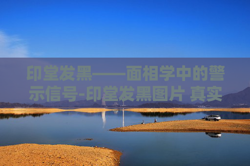 印堂发黑——面相学中的警示信号-印堂发黑图片 真实