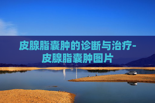 皮腺脂囊肿的诊断与治疗-皮腺脂囊肿图片