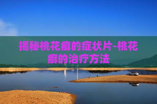 揭秘桃花癣的症状片-桃花癣的治疗方法