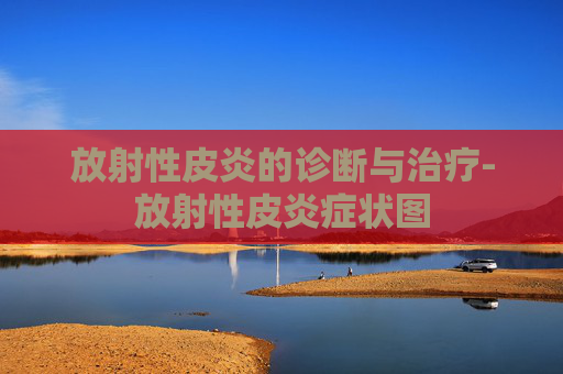 放射性皮炎的诊断与治疗-放射性皮炎症状图